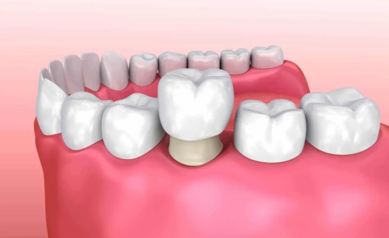 Soothing Care Dental