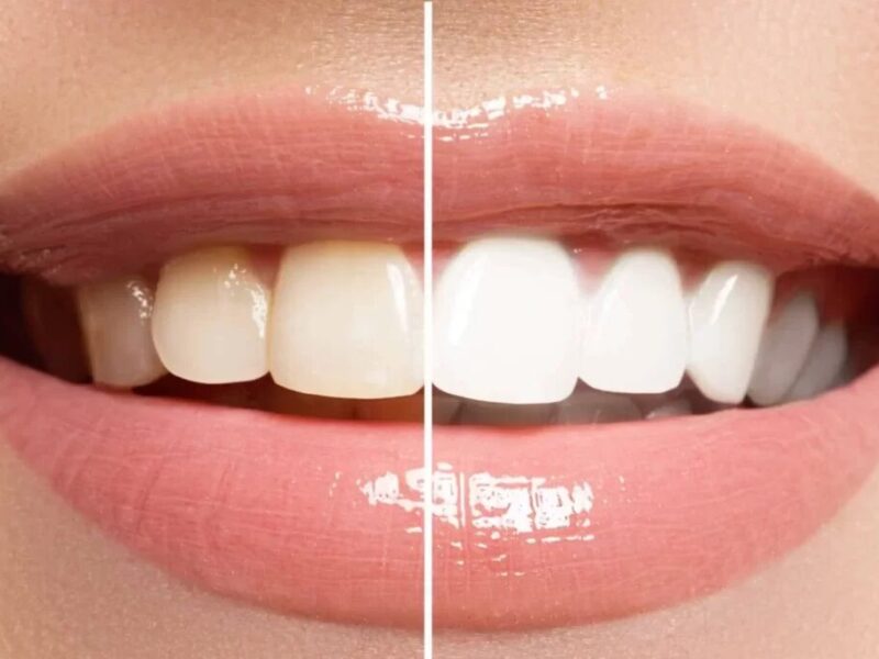 Soothing Care Dental