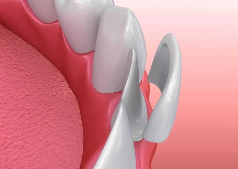 Soothing Care Dental